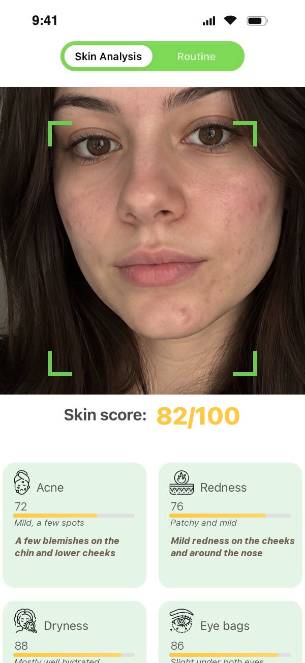 Skin Scan results in Green Point with a skin score and skin concerns